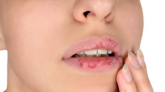 Tips Menjaga Bibir Agar Tidak Pecah-Pecah